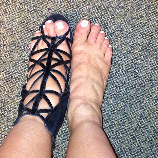 Kim's Swollen Feet posted in Twitter Kim Kardashian's swollen feet