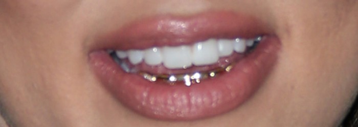 The gold grillz are shown in detail, reinforcing the rebellious accessory choice that amplified the outfit’s high-fashion-meets-street aesthetic