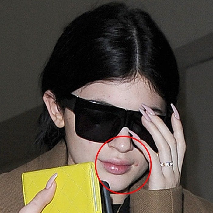 Kylie Jenner kept things understated behind oversized sunglasses as she arrived at Heathrow, her fresh-faced look showing a small blemish—proof that even the most polished stars have real-life beauty moments