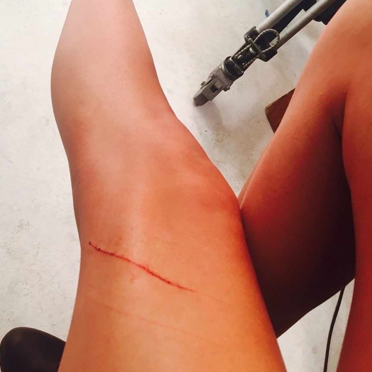 Taylor Swift says her Scottish Fold cat Meredith owes her $40 million after scratching her legs