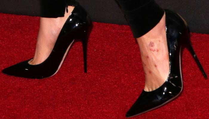 Cara Delevingne stepped onto the red carpet in Jimmy Choo’s sleek “Anouk” pumps, revealing visible marks on her foot that contrasted with the polished black patent stilettos