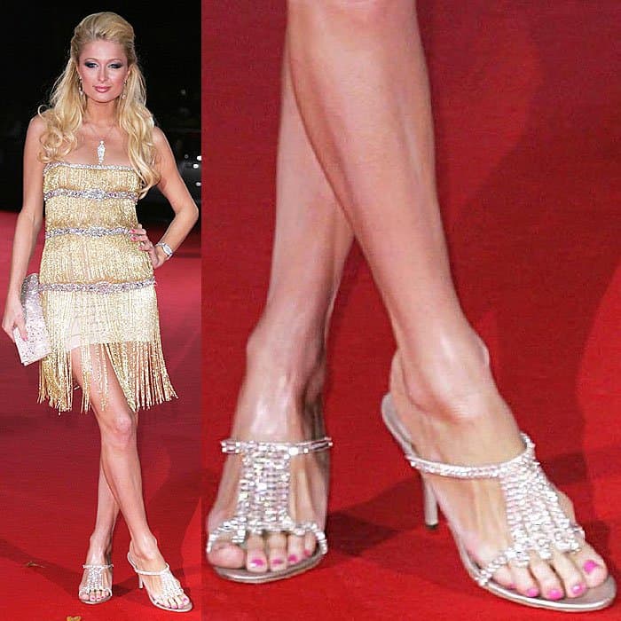 Paris Hilton dazzling in sparkly sandals on the red carpet, with visible bunions highlighting the effects of frequent high-heel wear