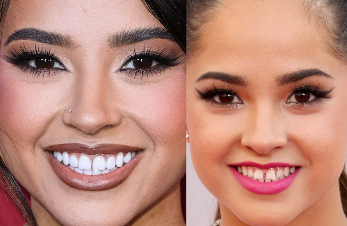 Becky G’s smile evolution: from her youthful trademark gap (right) to a refined, camera-ready look (left) that complements her modern red-carpet style
